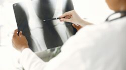 5 Kiat Mencegah Osteoporosis untuk Tetap Kuat