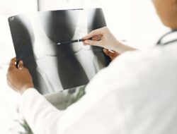 5 Kiat Mencegah Osteoporosis untuk Tetap Kuat